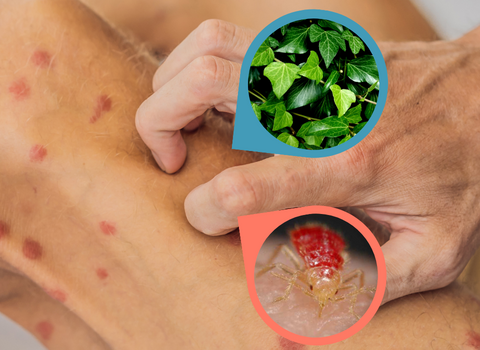 Bed_Bug_Bite_Poison_Ivy_Rash_8