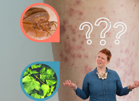 Bed_Bug_Bite_Poison_Ivy_Rash_9