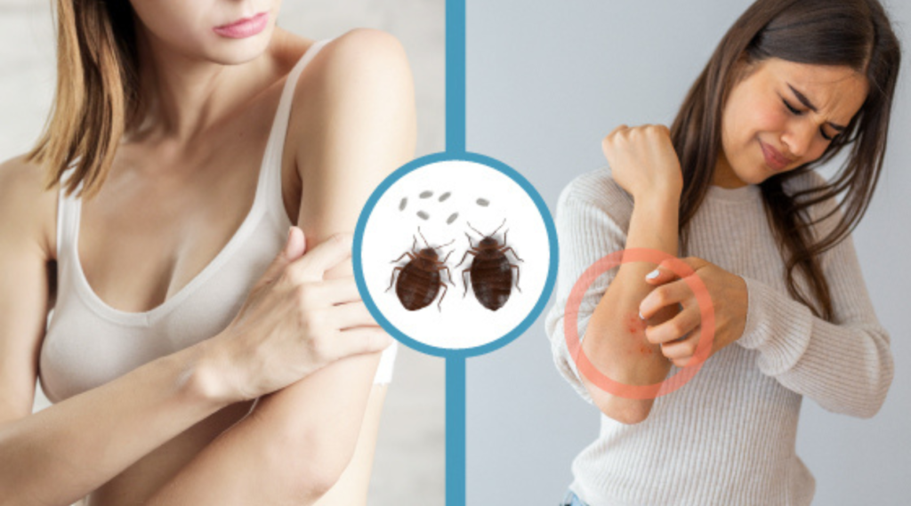 Why Do Bed Bugs Bite Some People and Not Others