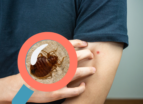 Do_Bed_Bug_Bites_Scar_1